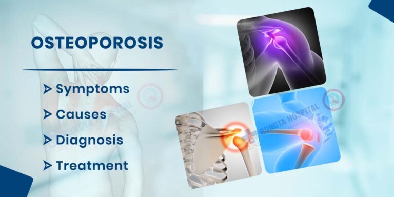 Osteoporosis: Symptoms, Causes Diagnosis, and Treatment