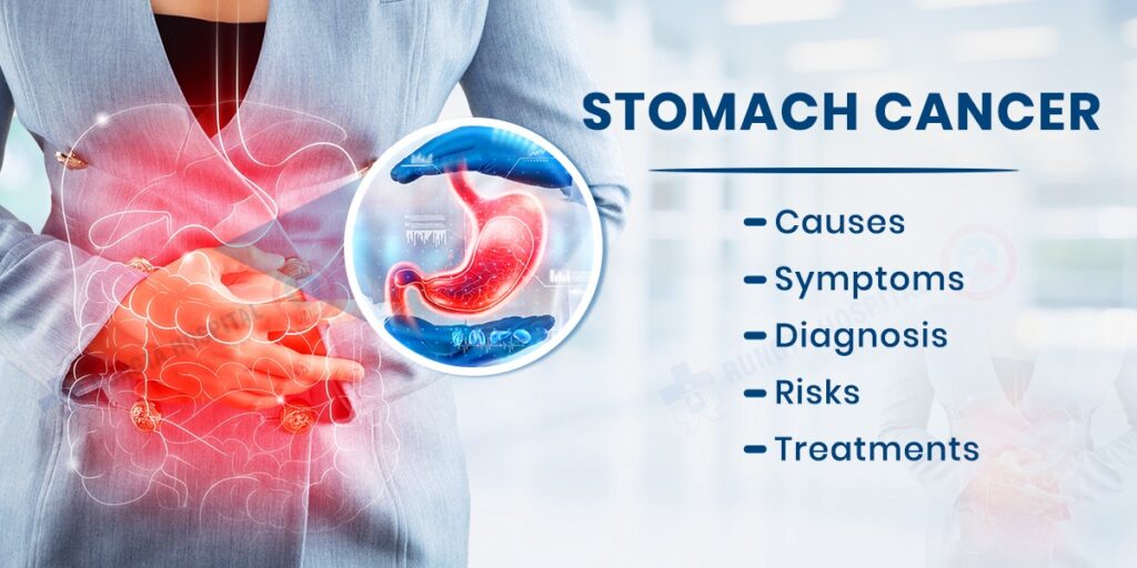 Stomach Cancer