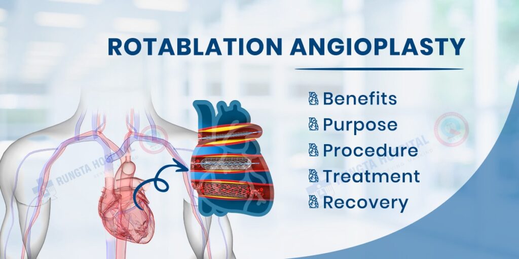Rotablation Angioplasty