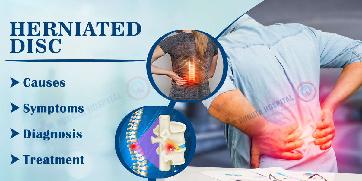 Herniated Disc: Causes, Symptoms, Diagnosis, and Treatments