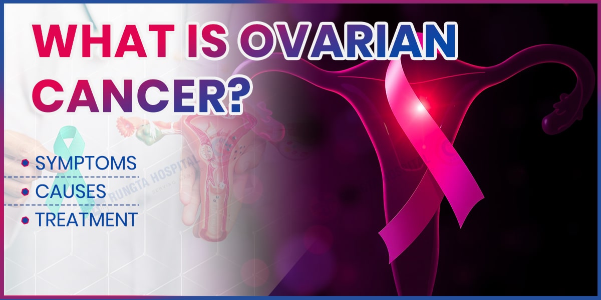 What is Ovarian Cancer