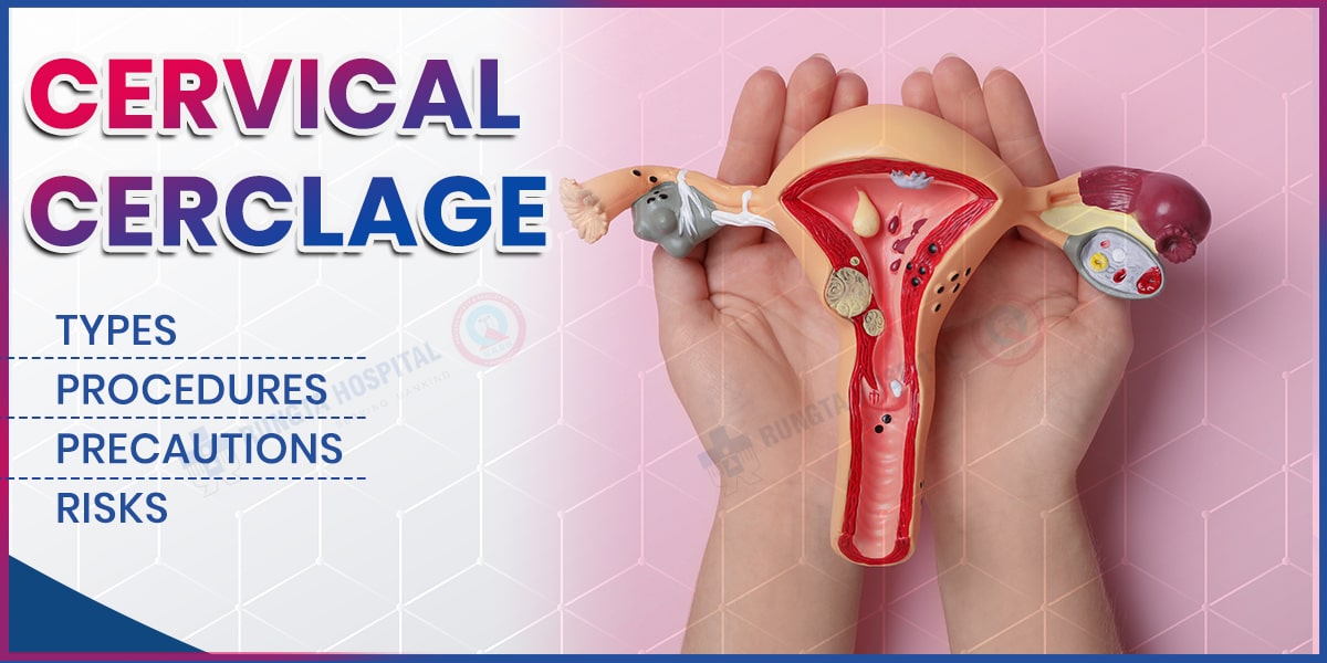 Cervical Cerclage