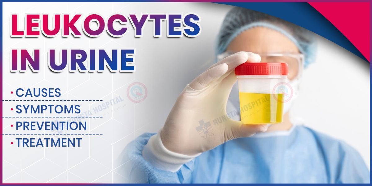 Leukocytes in Urine Causes, Symptoms, Prevention and Treatment