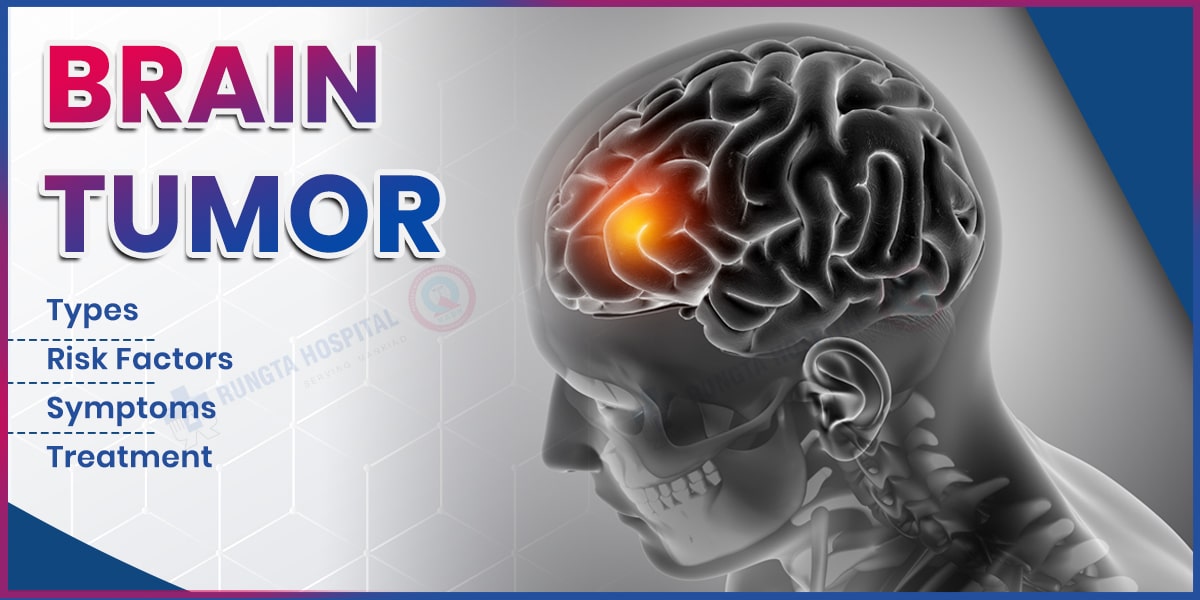 Brain Tumor: Types, Risk Factors, Symptoms, and Treatment