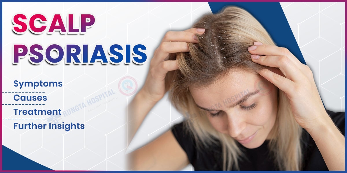 Scalp Psoriasis: Symptoms, Causes, Treatment,