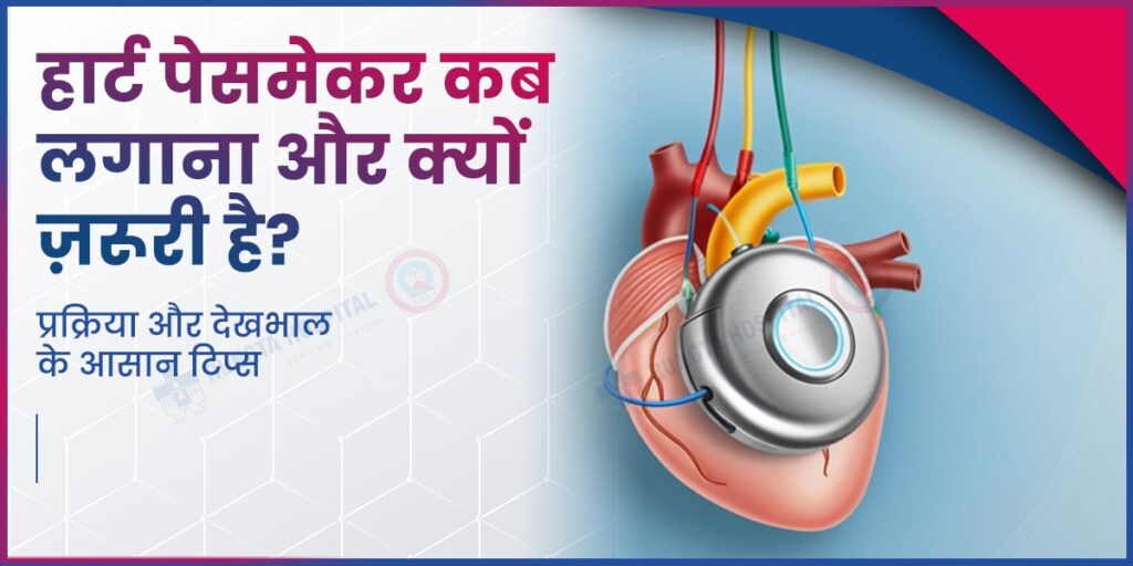 हार्ट पेसमेकर कब लगाना और क्यों ज़रूरी है