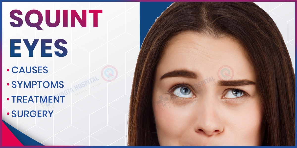 Squint Eyes: Causes, Symptoms, Treatment, and Surgery
