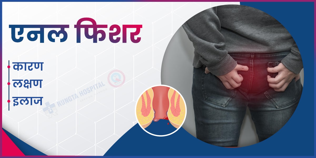 एनल फिशर के कारण, लक्षण और इलाज-min