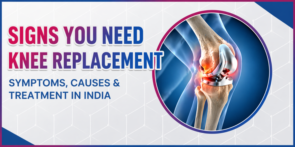 Signs you need knee replacement