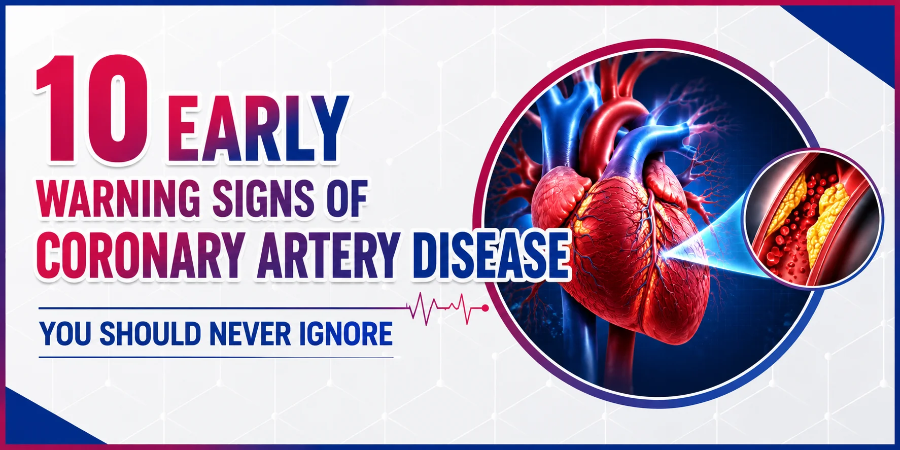 10 Early Warning Signs of Coronary Artery Disease