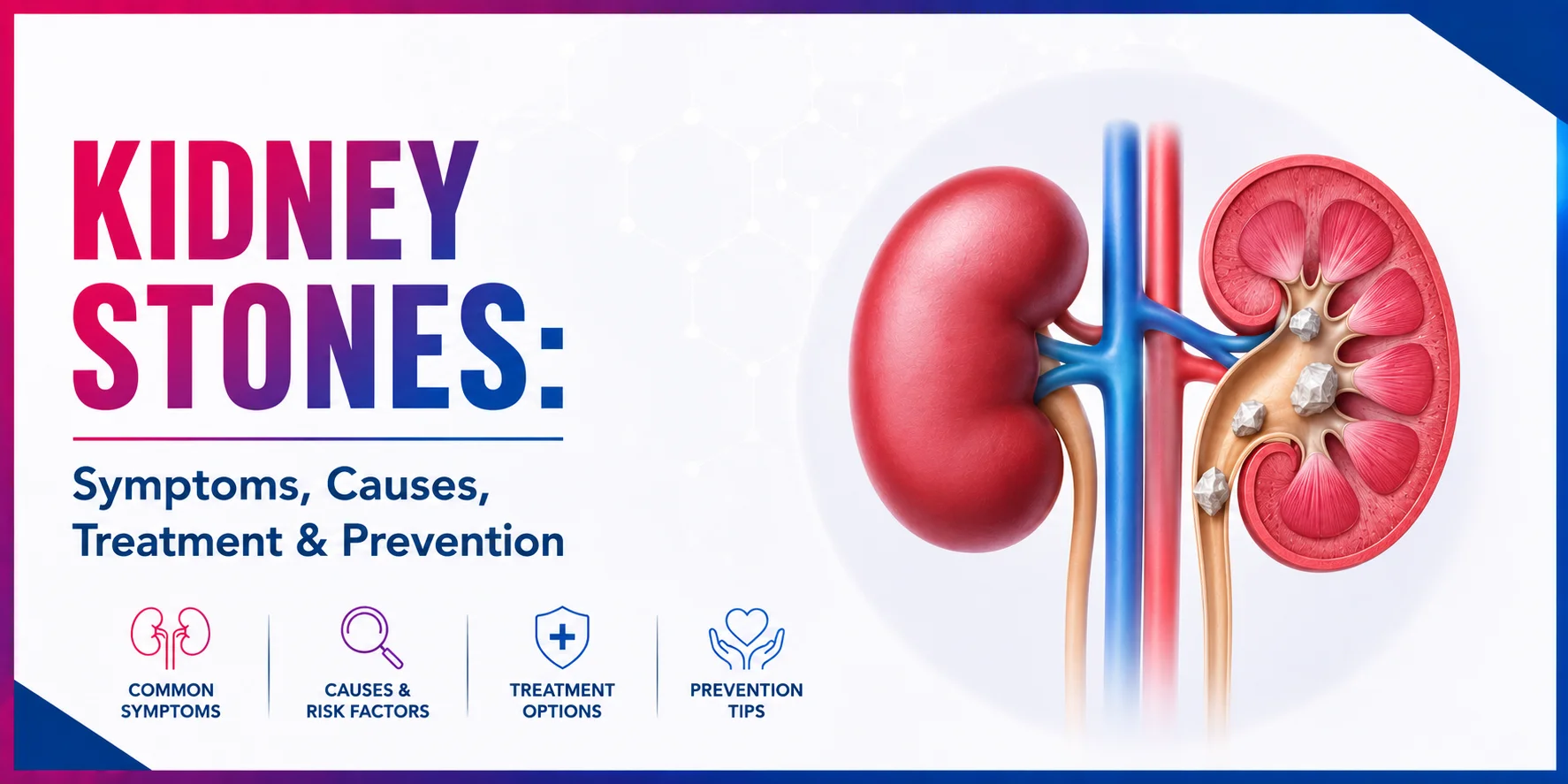 Kidney stones symptoms causes treatment